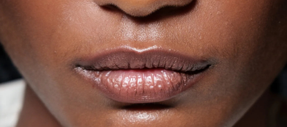 polynucleotides for lips
