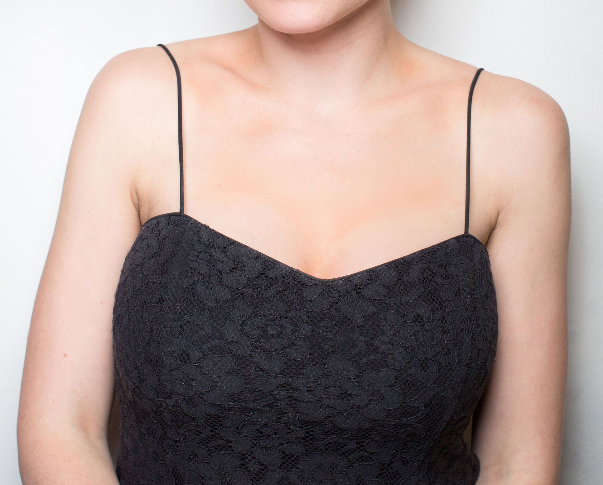 décolletage contouring 4 after