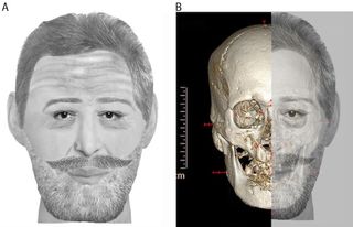 A facial reconstruction of Henry IV based on a mummified head held in a private collection.