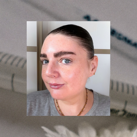 Laura Pearson reviews SKINVIVE and HArmonyCa