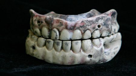 A set of dentures