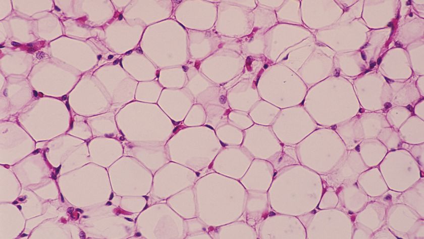 a close-up of fat cells under a microscope