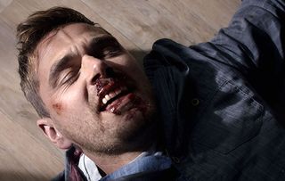 Down and out. Iain is left bloodied after a bar brawl in Casualty