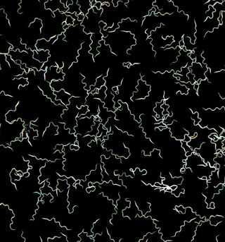 Researchers have found the sperm (shown here magnified 50 times in micrograph) of the mosquito <em>Aedes aegypti</em> is equipped with odor-detecting molecules.