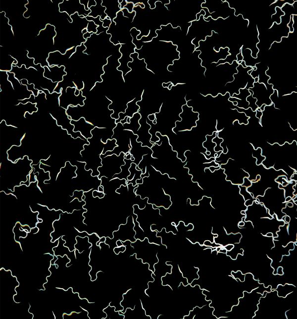 Researchers have found the sperm (shown here magnified 50 times in micrograph) of the mosquito &lt;em&gt;Aedes aegypti&lt;/em&gt; is equipped with odor-detecting molecules.