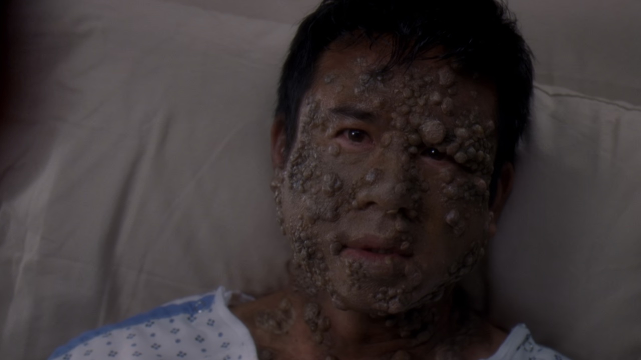 32 Weird Diseases And Injuries That Came Up On Grey’s Anatomy