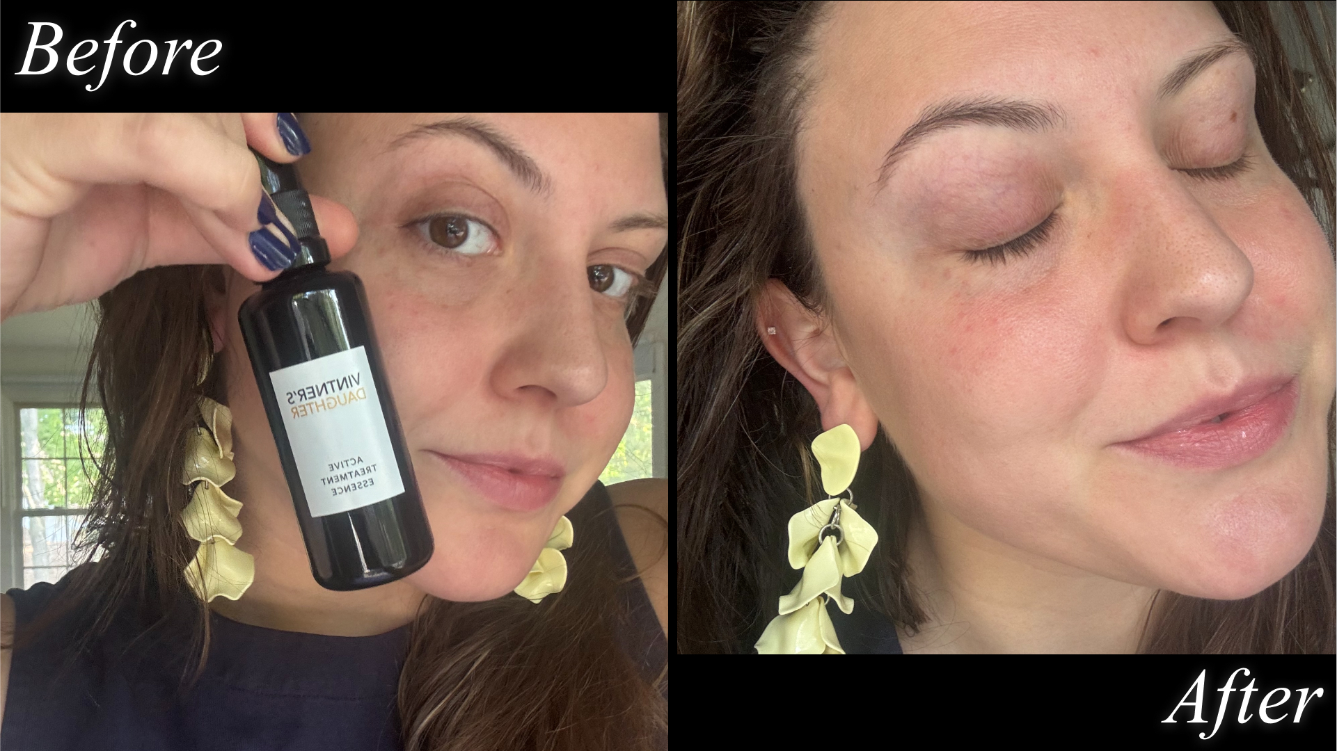 Sophia Vilensky pictured before and after testing Vintner&#039;s Daughter&#039;s toner essence.