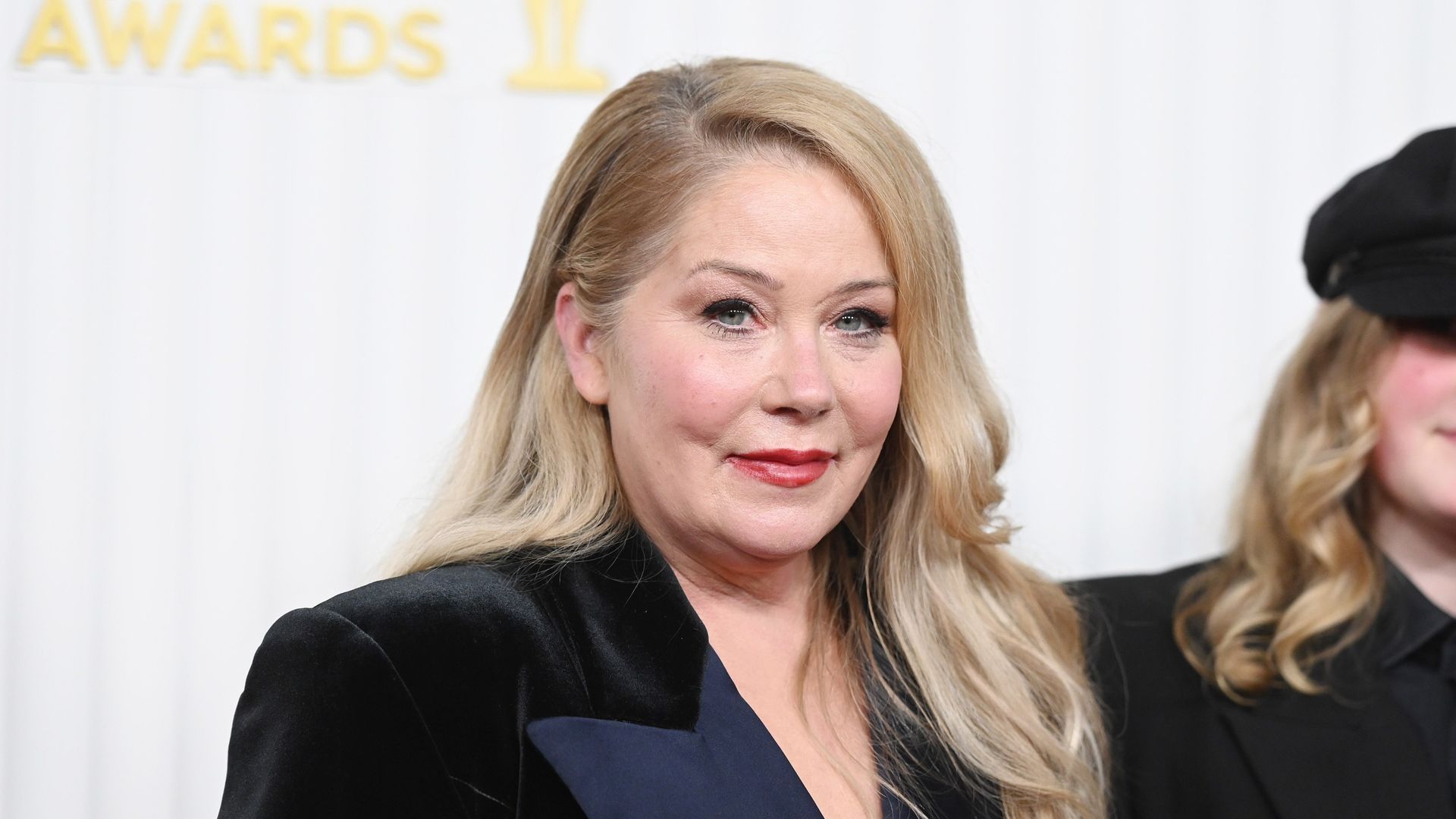 Christina Applegate misdiagnosis: Why can MS be difficult to diagnose?