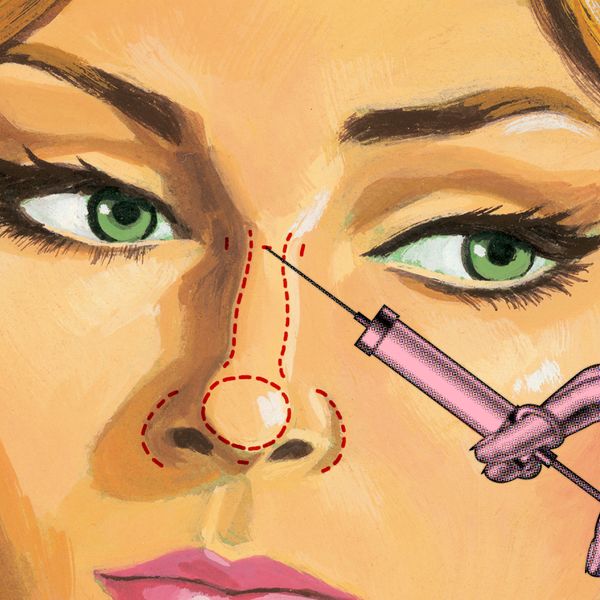 You Can Get a Nose Job With Exclusively Fillers—So What's the Catch