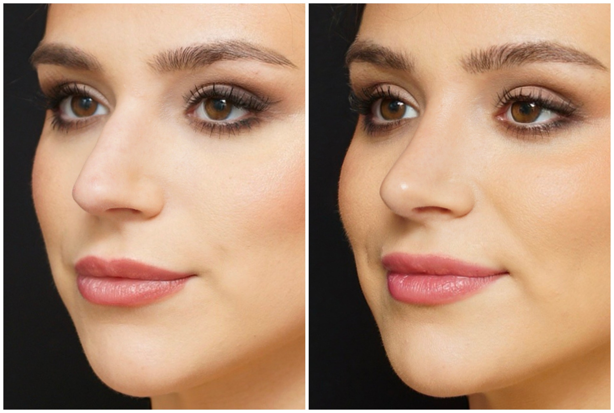 before and after