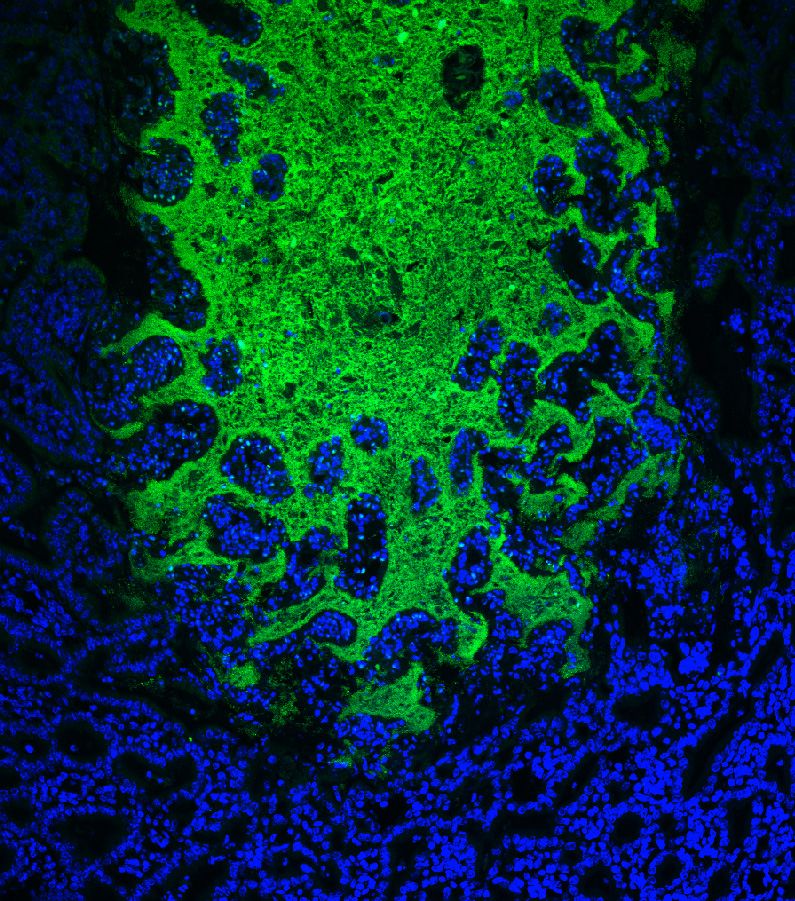 Bacteria overgrowth in the gut.