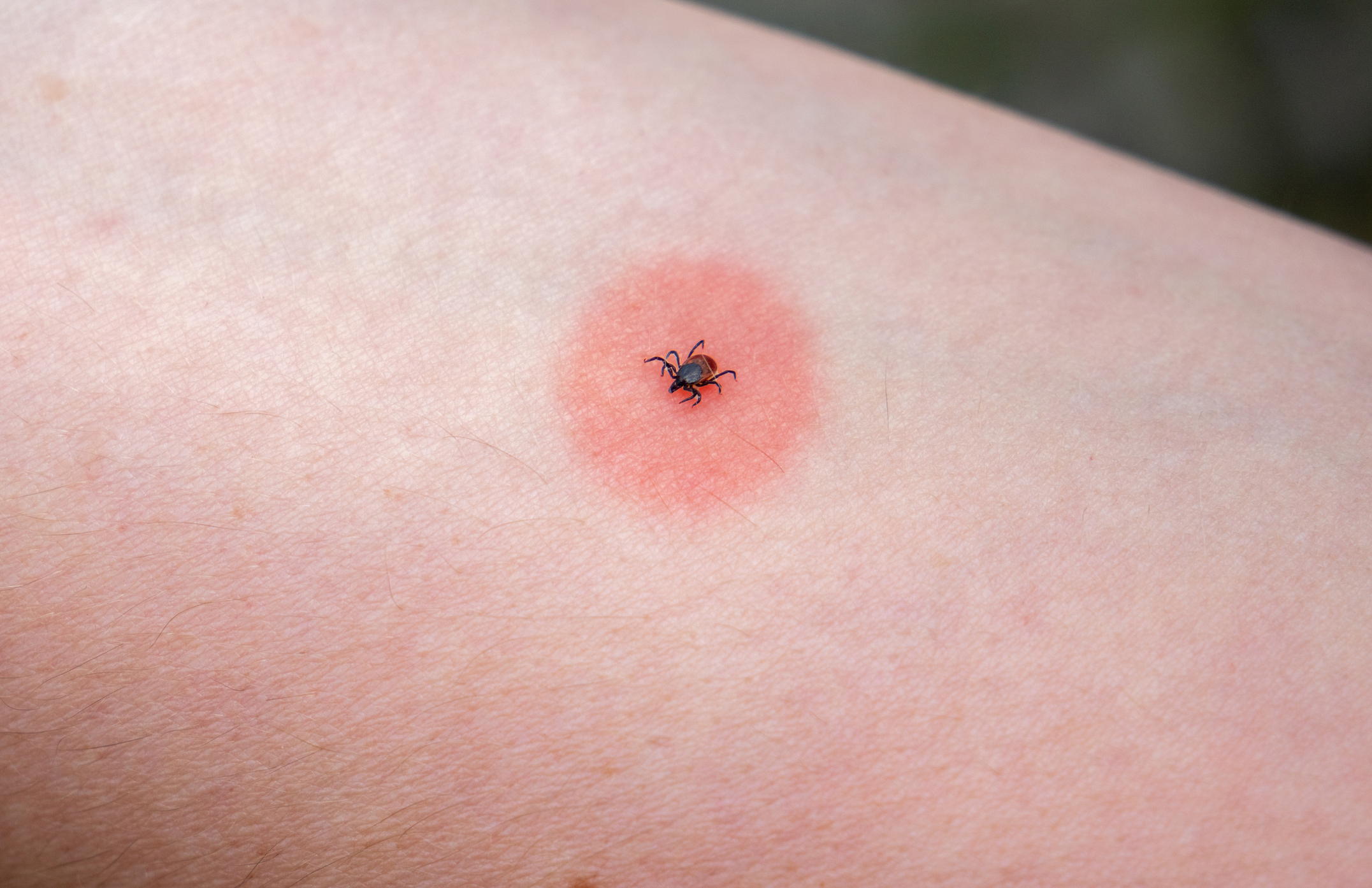 tick