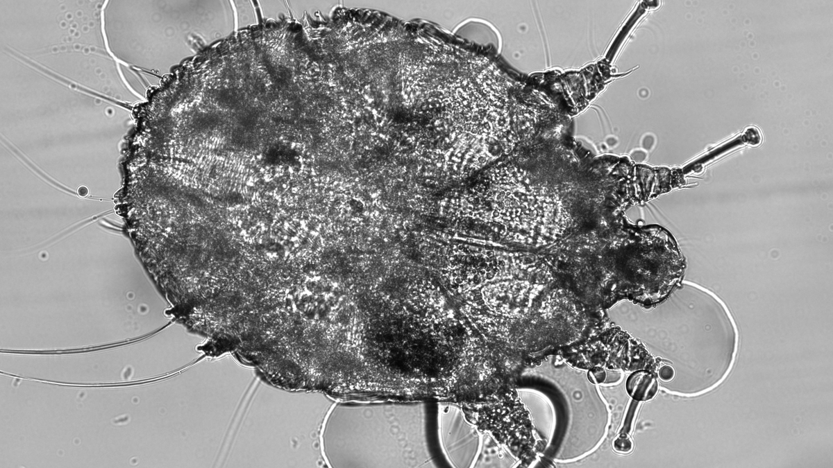 Yes scabies can live in mattresses — here's what experts want you to