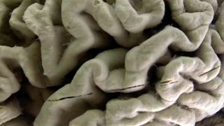 Close up on wrinkled human brain tissue