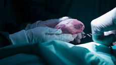 a gloved surgeon's hands holding a human heart that they're preparing for transplant. A second surgeon's gloved hands can be seen reaching over the patient's covered body to adjust something