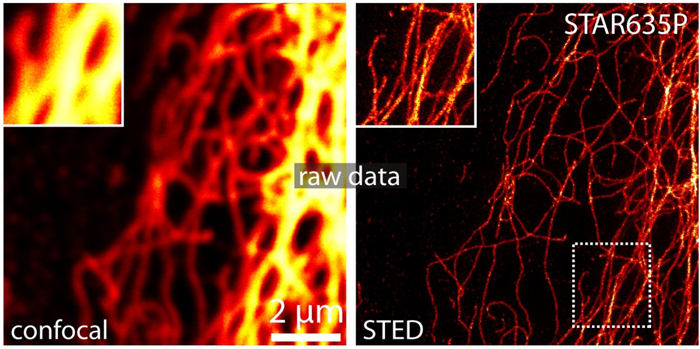 Microscope images of human protein vimentin. Note the higher resolution on the right.