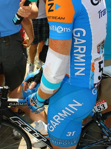 Farrar badly hurt his elbow on the Stockeu descent and the wound was already oozing through the bandage even before the start of Stage 3.