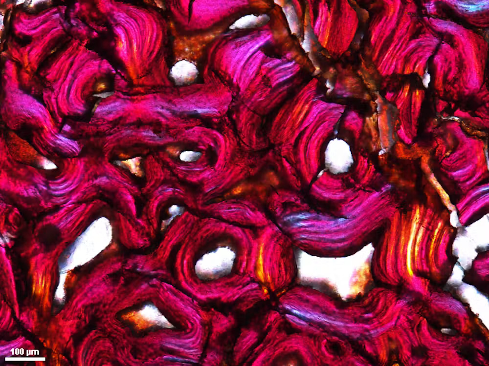 A close up of red cells under a microscope