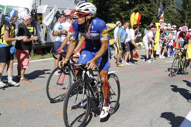 Philippe Gilbert diagnosed with broken knee cap... which he rode with for 59km at the Tour de France