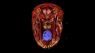 The isopods parasitize fish through their gills, and then grow to be tongue-size as they consume their hosts' tongues.