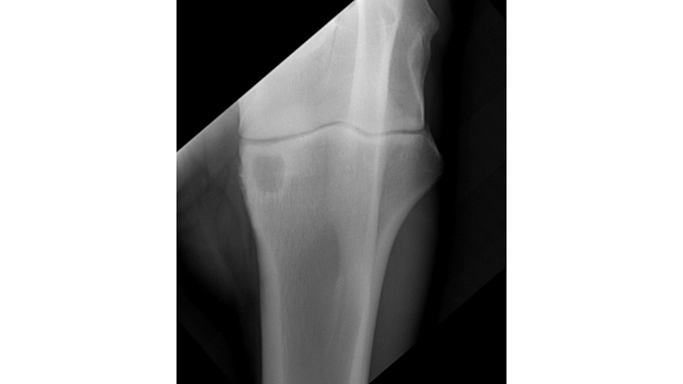 xray-Hamlet-elbow-Peter-Milner_265526291_439666041.jpg