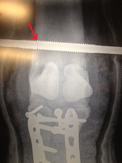 St Nicholas X-Ray