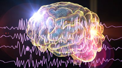 A cartoon image of a brain with waves across the front of it. 