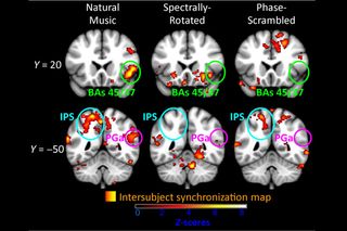 These fMRI images show areas of the fronto-parietal cortex that responded in similar ways across study participants as they listened to three variations of a symphony. Synchronization was strongest when participants listened to the original, unaltered symphony.