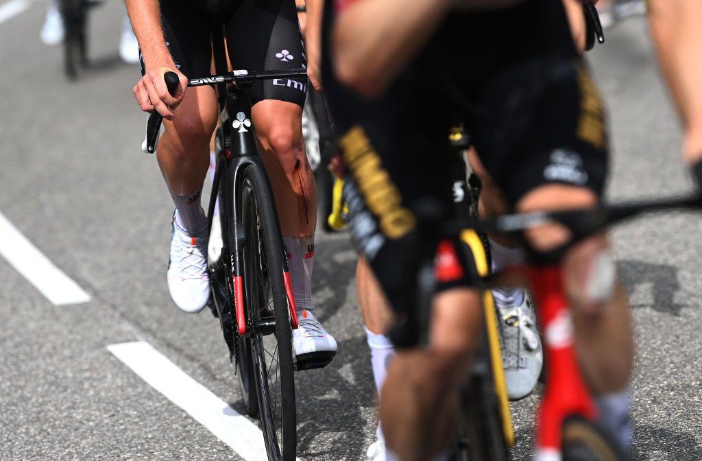 COURCHEVEL FRANCE JULY 19 Detail view of an injury of Tadej Pogacar of Slovenia and UAE Team Emirates White Best Young Rider Jersey during the stage seventeen of the 110th Tour de France 2023 a 1657km at stage from SaintGervais MontBlanc to Courchevel UCIWT on July 19 2023 in Courchevel France Photo by Tim de WaeleGetty Images
