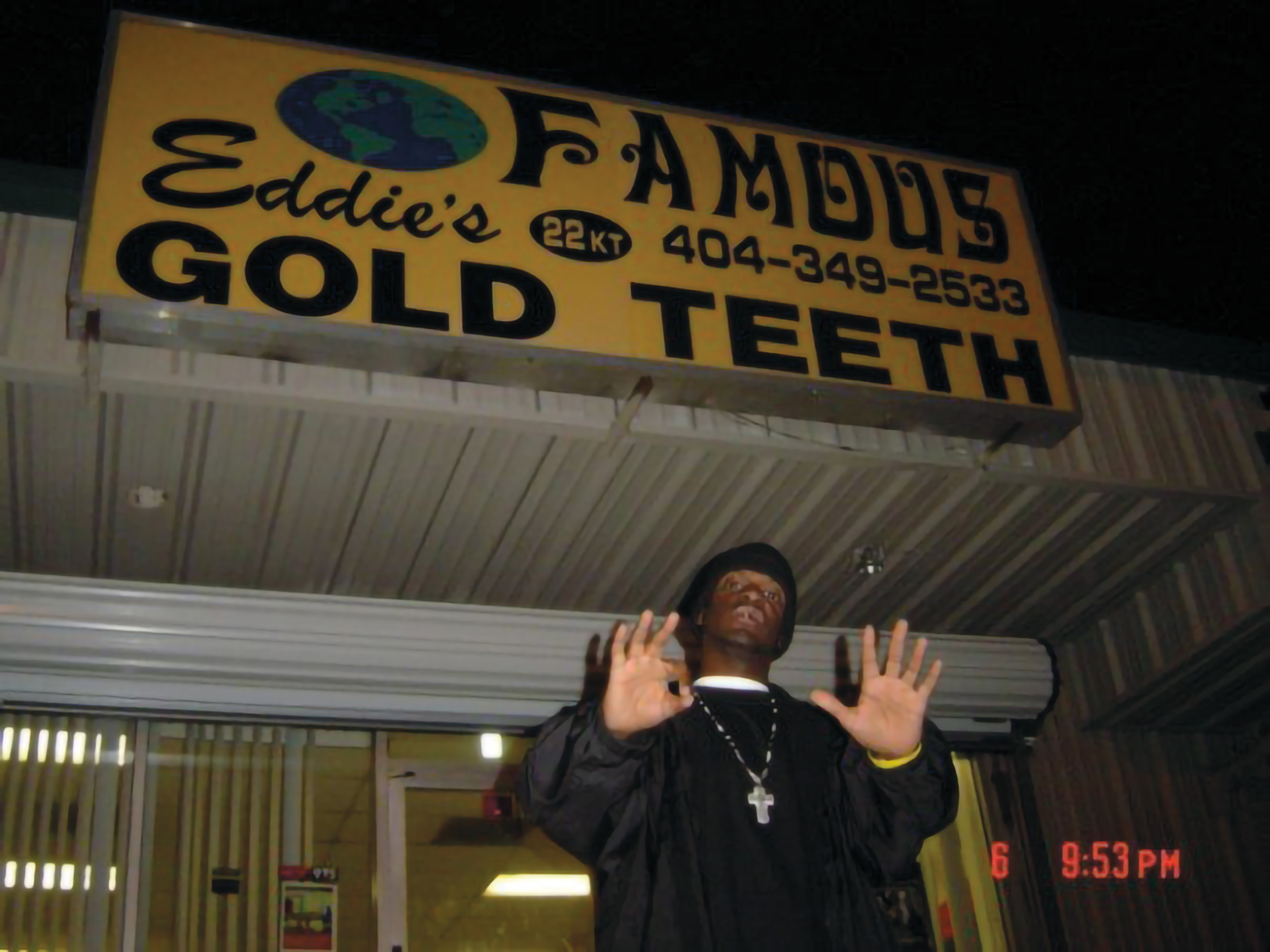 gold teeth