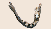 a human mandible missing several teeth against a peach-colored background