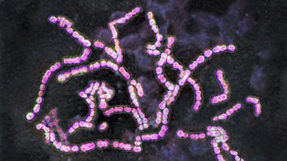 Strep A bacteria