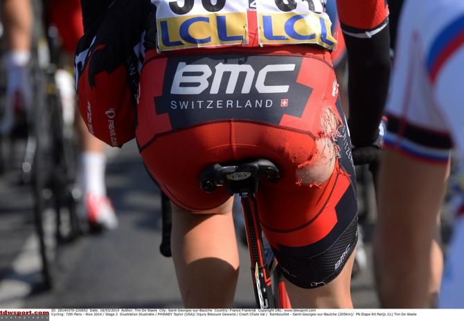 Taylor Phinney's right side showing the aftermath of a crash