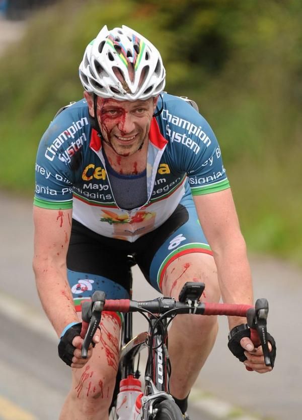 Martin Mizjayski (Tipperary Carrick Iverk Produce) continues to race despite a crash during the first stage of 2012 An Post R