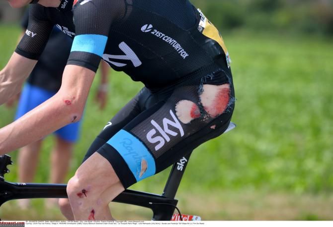 A raw and bloody left hip for Froome