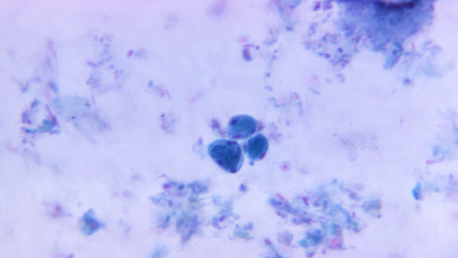 A photo of Blastocystis hominis, a parasite that causes blastocystis.