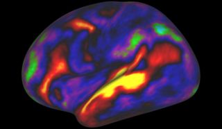 brain, brain scan, brain map