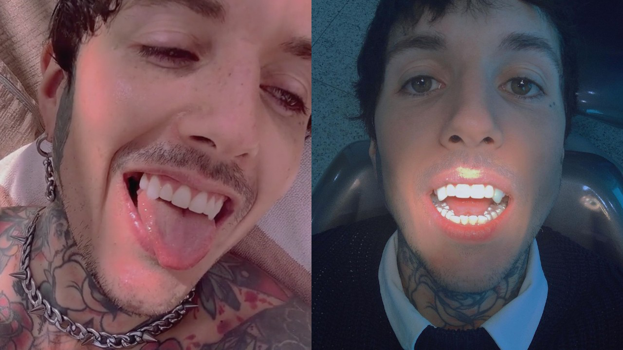 So, Bring Me The Horizon's Oli Sykes has got permanent vampire fangs now