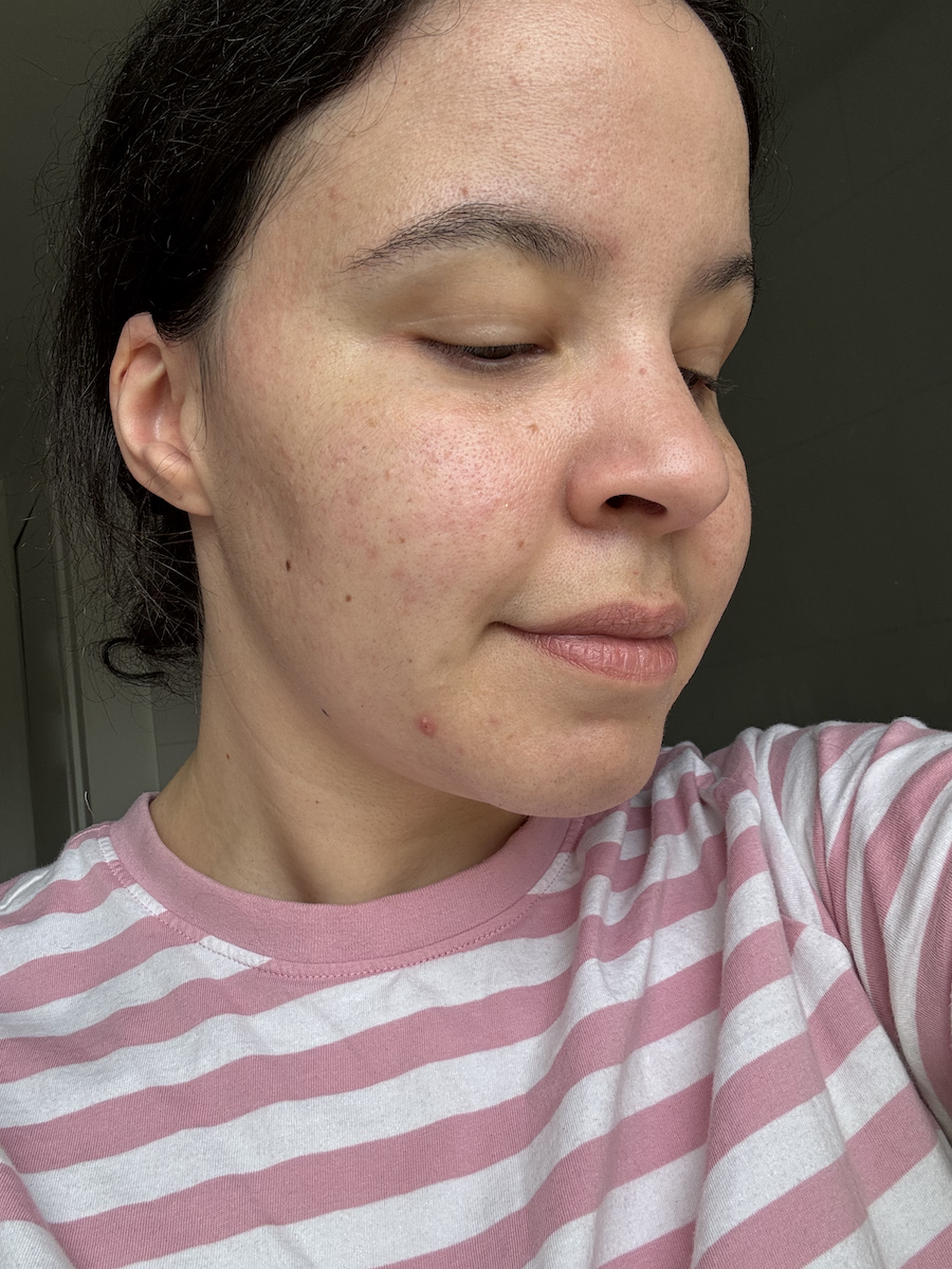 Mica Ricketts before using Ziip Dot