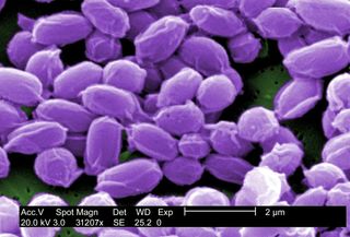 Anthrax spores