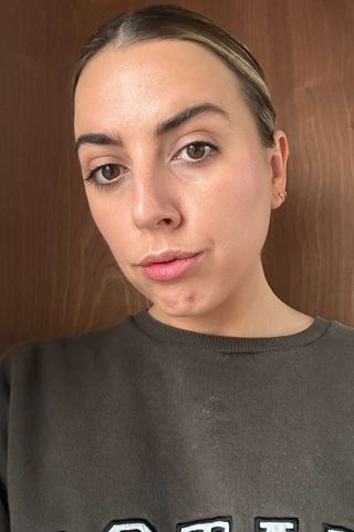 Shannon Lawlor wearing the best concealer for acne