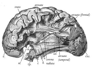 Neuroanatomist Theodor Meynert left out the vertical occipital fasciculus in the last article he published before his death in 1892.
