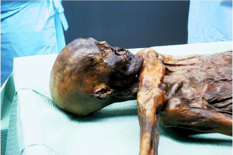 Iceman Mummy Suffered Head Blow Before Death