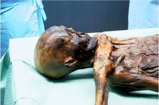 The mummified body of Ötzi.