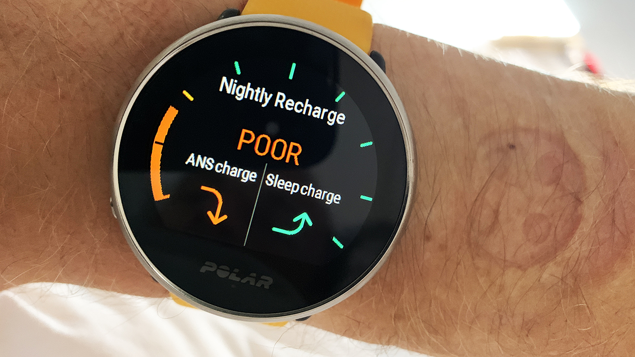 Polar Ignite