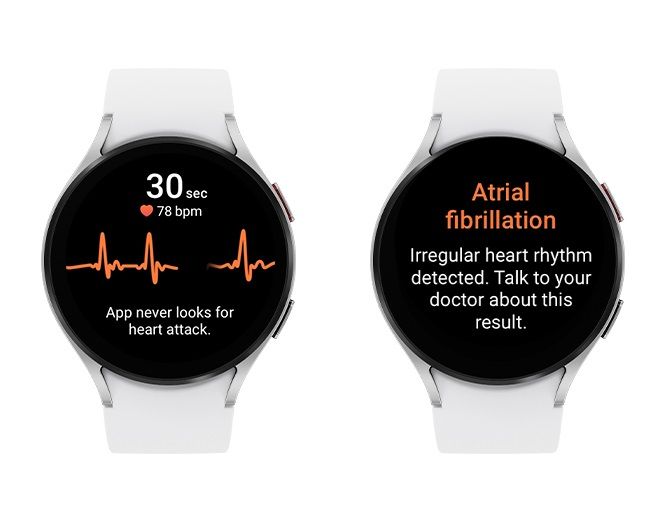 An ECG reading on the Galaxy Watch 5 detecting AFib heart measurements.