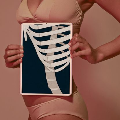 a design featuring a woman wearing undergarments and holding an x ray of a skeleton to her ribcage