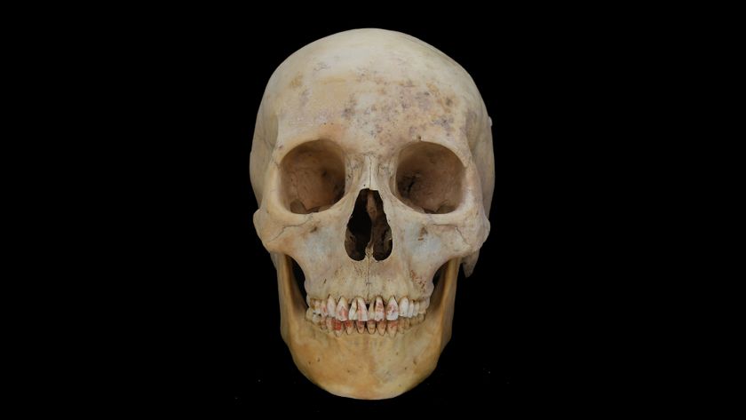 a photo of a skull with red-stained teeth