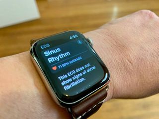 Report watchOS 7.2 will check for AFib at higher heart rates than