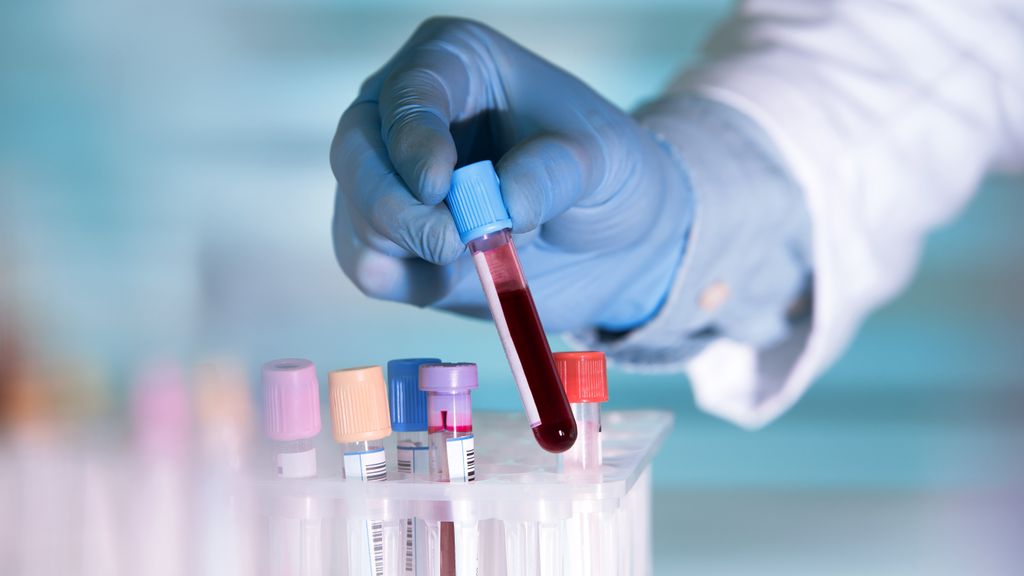 Raspberry Pi powered Blood Test Kit Could Help Save Lives Someday 